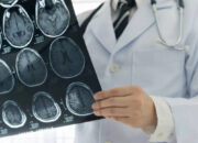 Simple Blood Test Can Predict Brain Diseases Years Before Symptoms, Says Neurologist